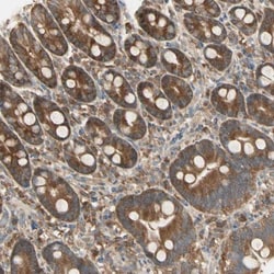 IRAG Antibody, Novus Biologicals:Antibodies:Primary Antibodies